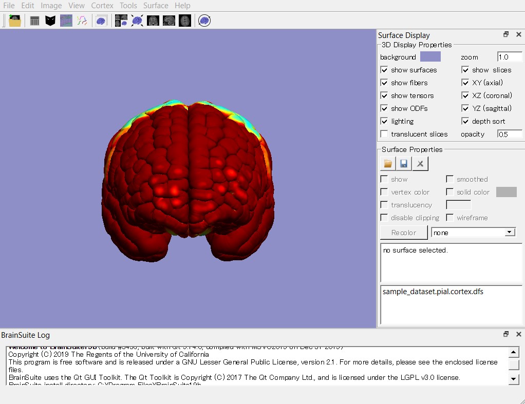 脳のdicomデータから3dプリント可能なモデルを作成する 年6月版 Hiatli